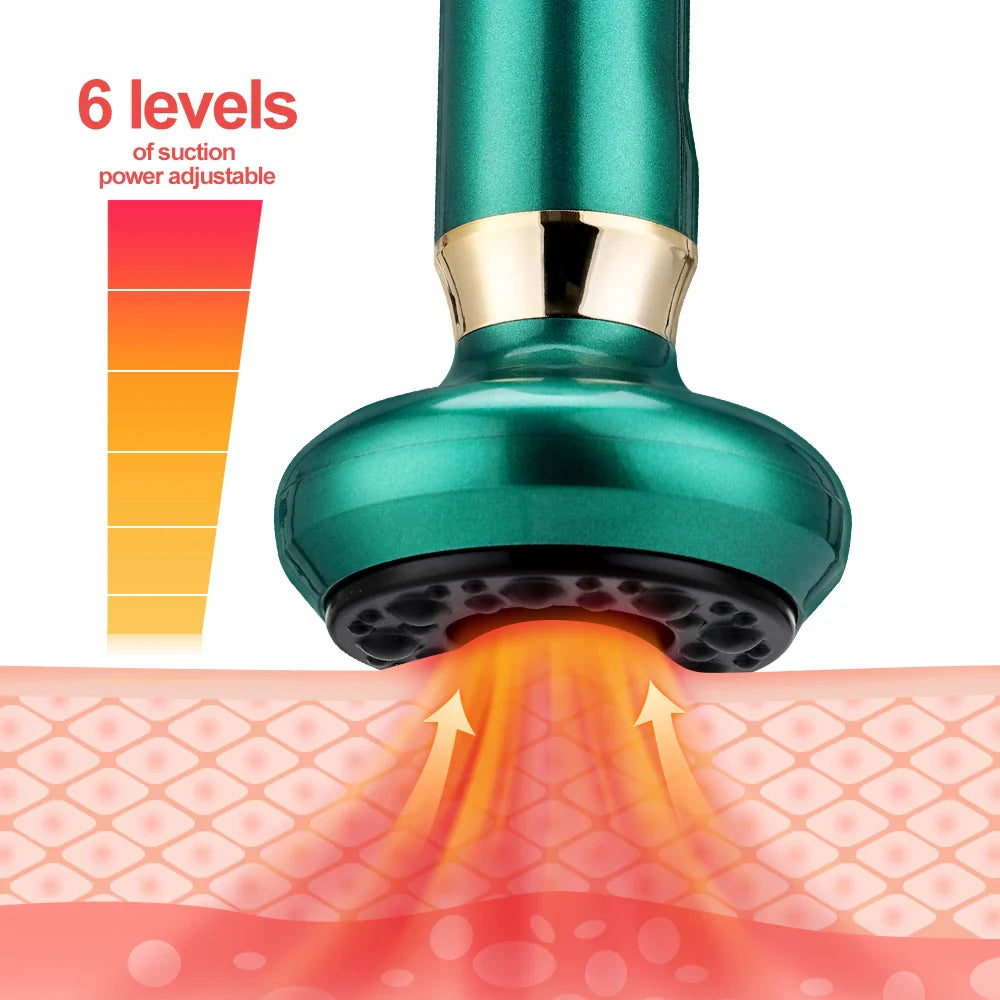 cupping massager – Infrared Vacuum Body Massager
